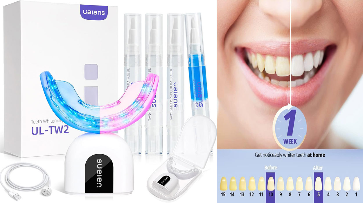 Chollo Blanqueador dental profesional Ualans con 32 LED por sólo 14,24€ con cupón descuento (-50%)