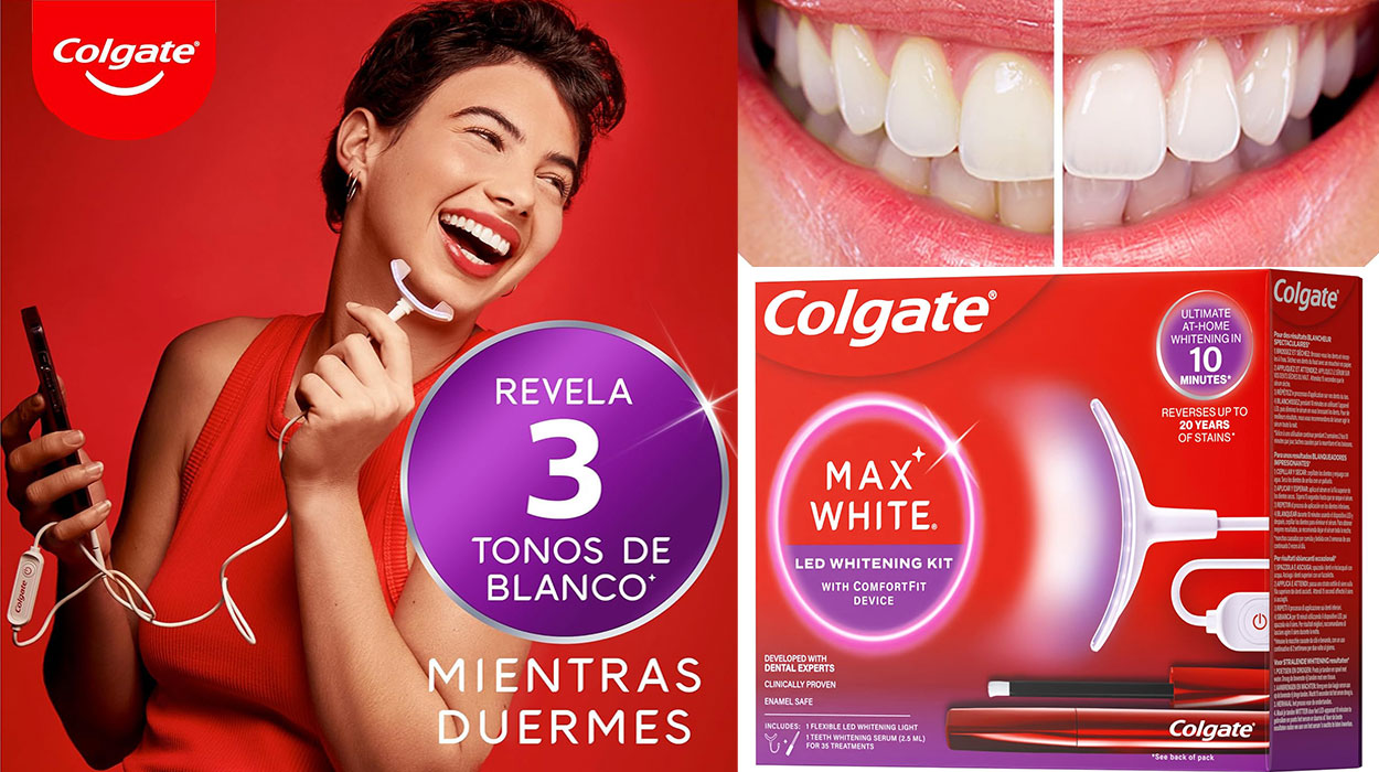 Chollo Kit de blanqueamiento dental LED Colgate Max White Ultimate por sólo 37,49€ con envío gratis (-63%)