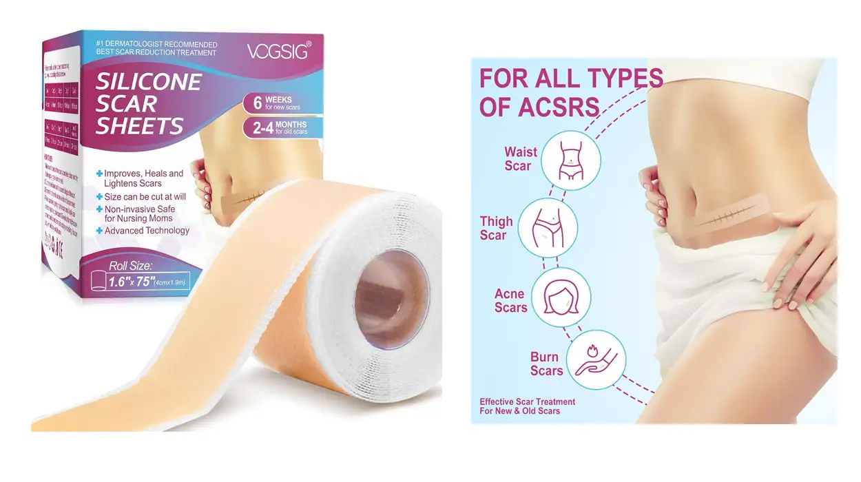 Chollo Hojas de silicona para tratamiento de cicatrices en cinta de 4 cm x 1,9 m por sólo 11,39€ (-24%)